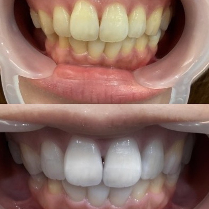 30代女性ビフォーアフター