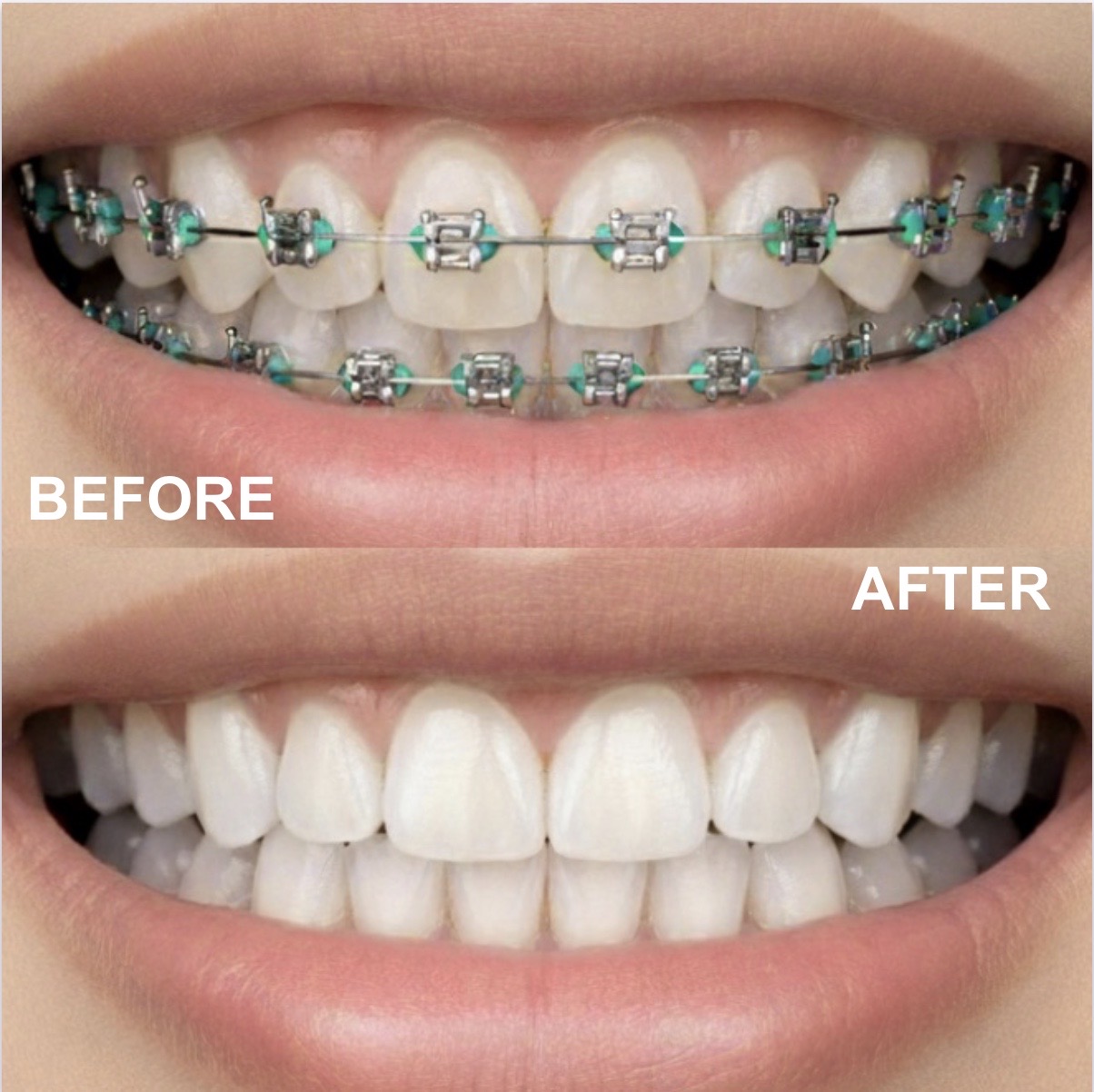 30代女性ビフォーアフター