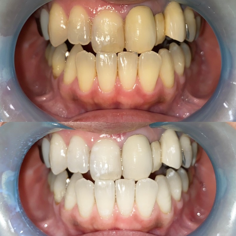 40代女性ビフォーアフター