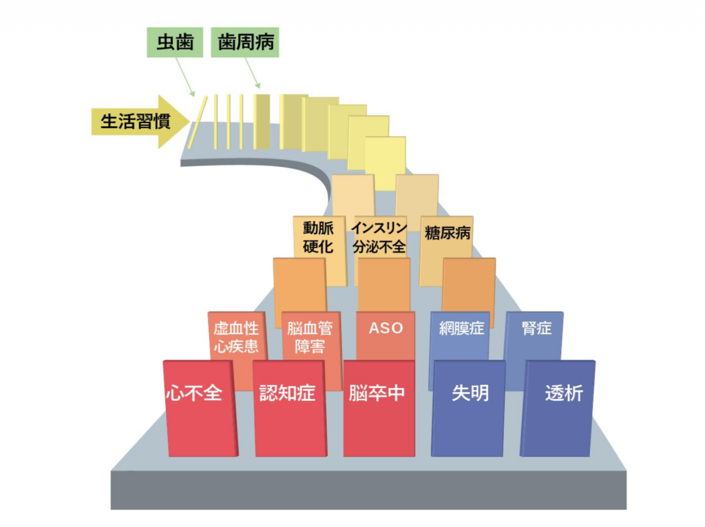 図解！メタボリックドミノ。ダンブラシュサンダ