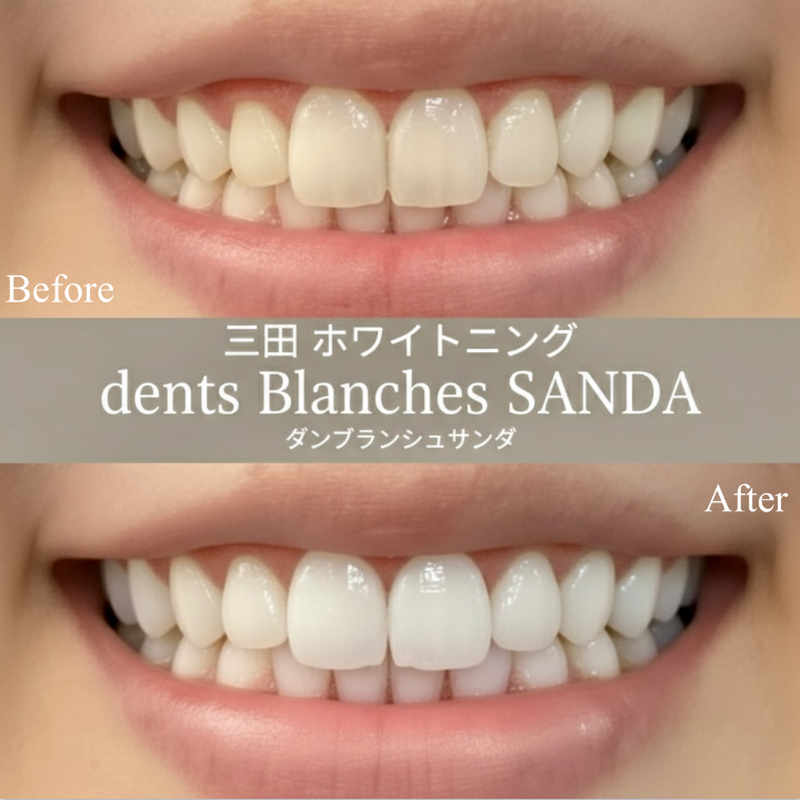 ビーフォアフター。効果もしっかり出ている。ダンブランシュサンダ